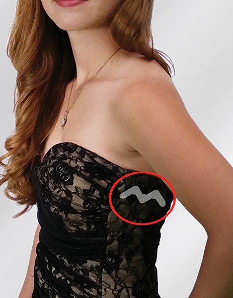 Braza UPSIE DAISIES - Klebebandstreifen für Kleidung